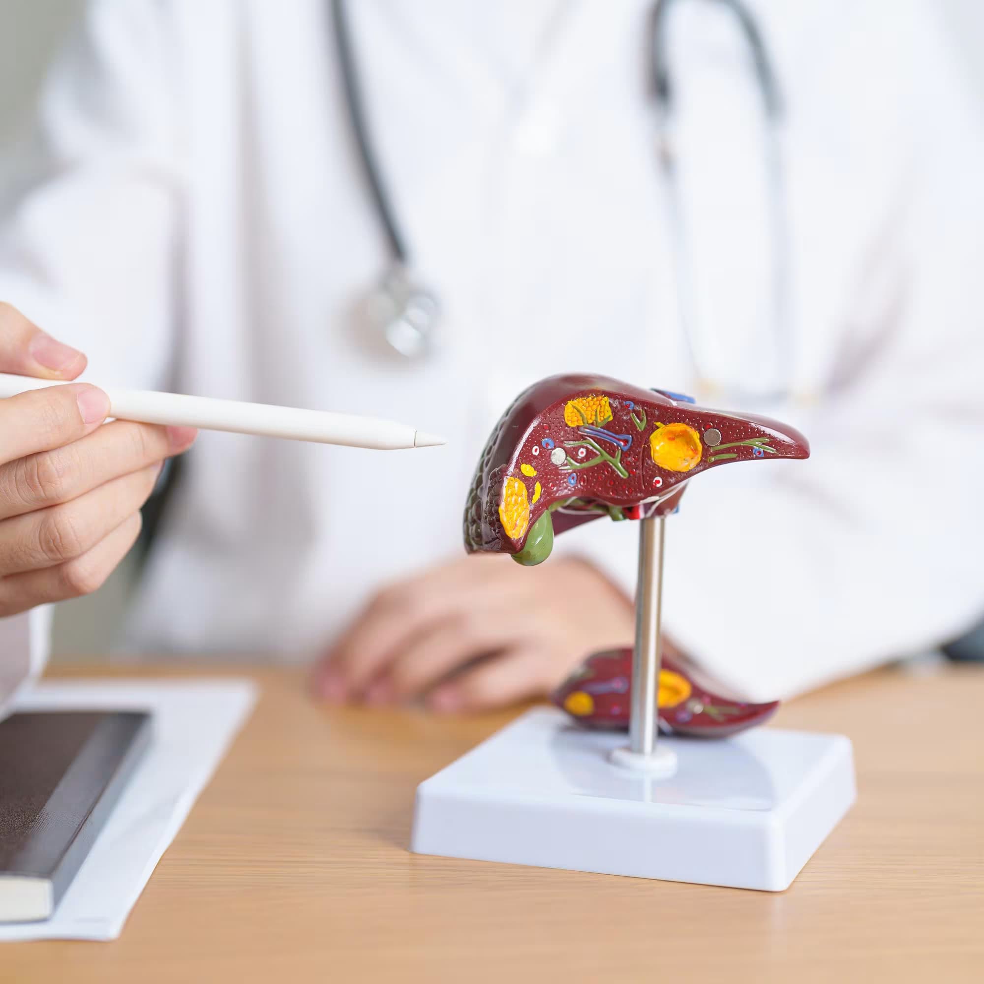 Fatty Liver